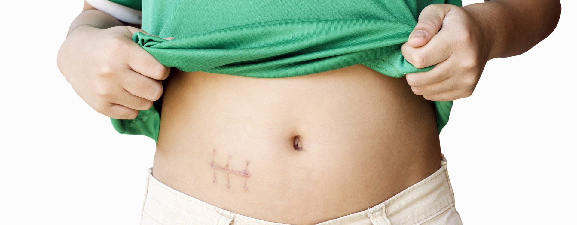 Escarres et cicatrisation : l'apport des huiles essentielles