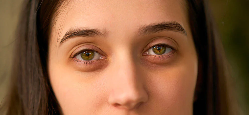 Comment atténuer ses cernes avec les huiles essentielles ?